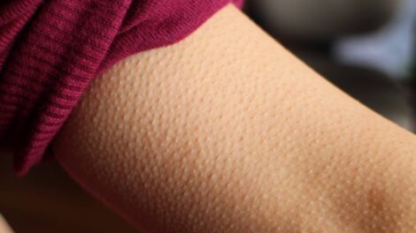 A libabőrért nem a hideg a felelős: ezek a testrészeink okolhatók miatta