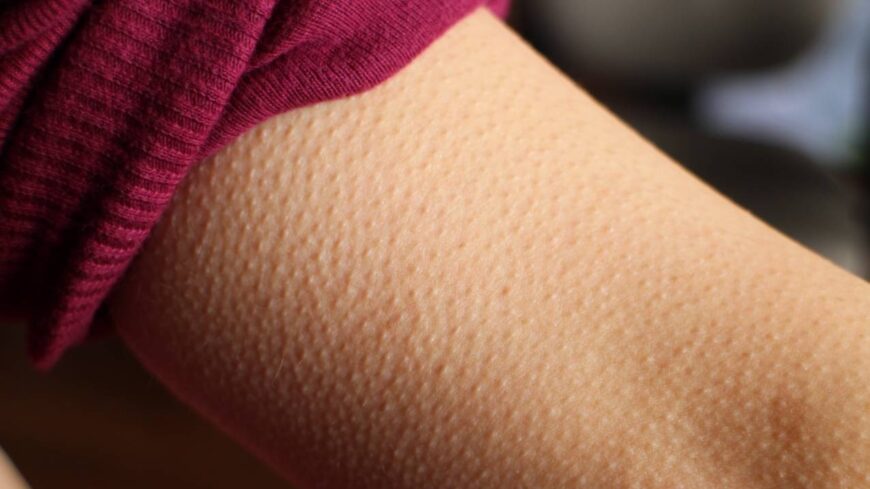 img_A_libaborert_nem_a_hideg_a_felelos__ezek_a_testreszeink_okolhatok_miatta