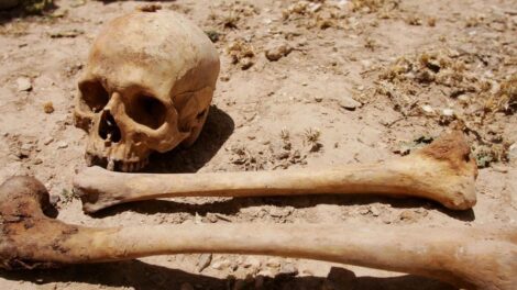 Bizonyítékot találtak a legkorábbi sebészeti eljárásra