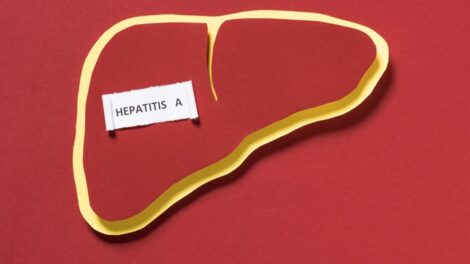 Emelkedik a hepatitis A-fertőzések száma Borsod-Abaúj-Zemplén megyében